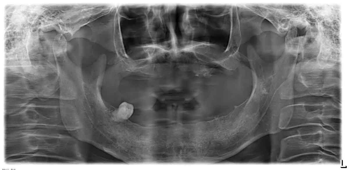 当院のインプラント症例実績